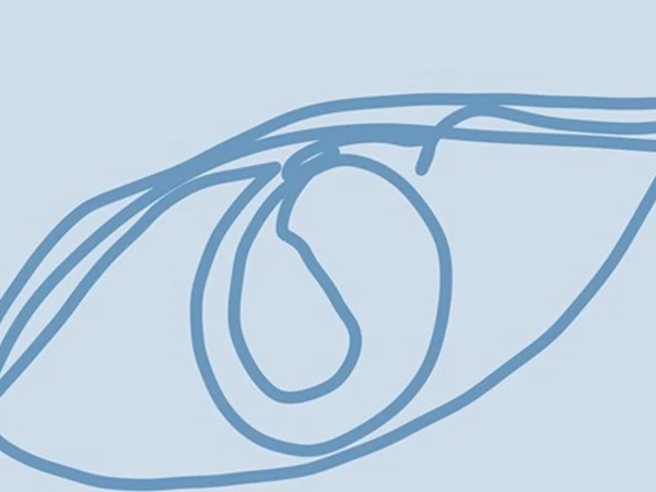 Lees meer